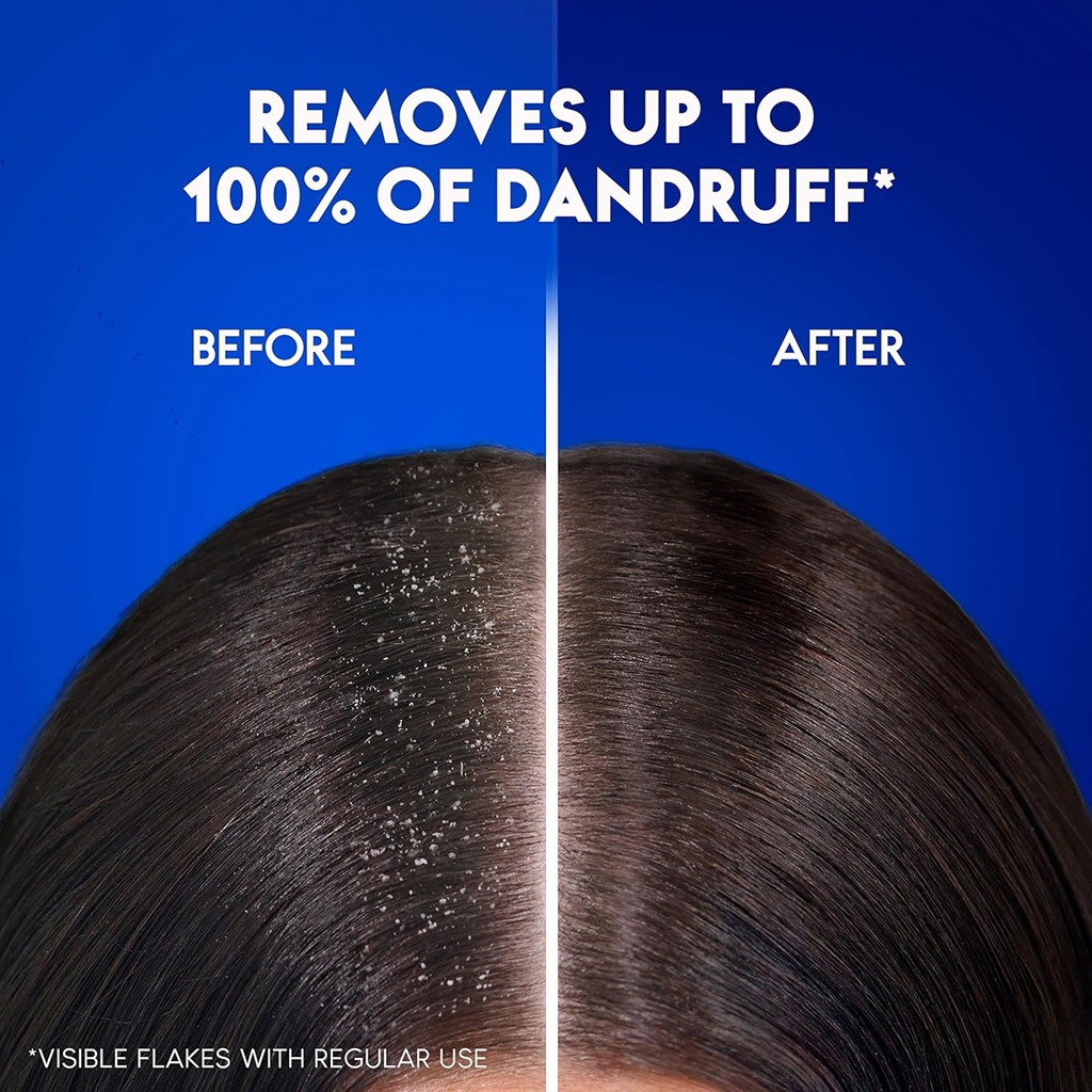 Apple Fresh Anti-Dandruff Shampoo 400 ml-1
