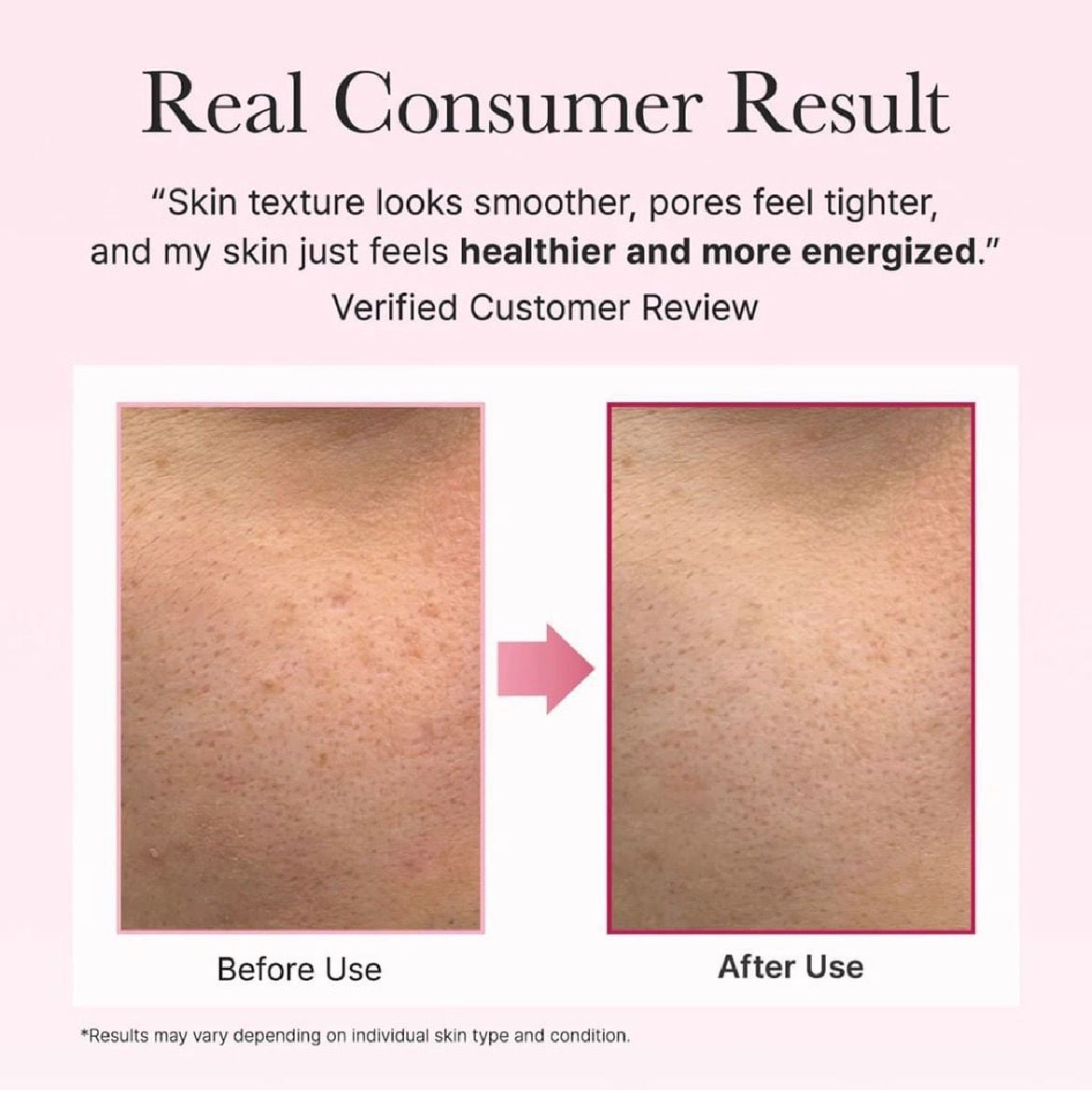 كريم تجديد البشرة بي دي آر إن بوستر شوت 30 مل 3