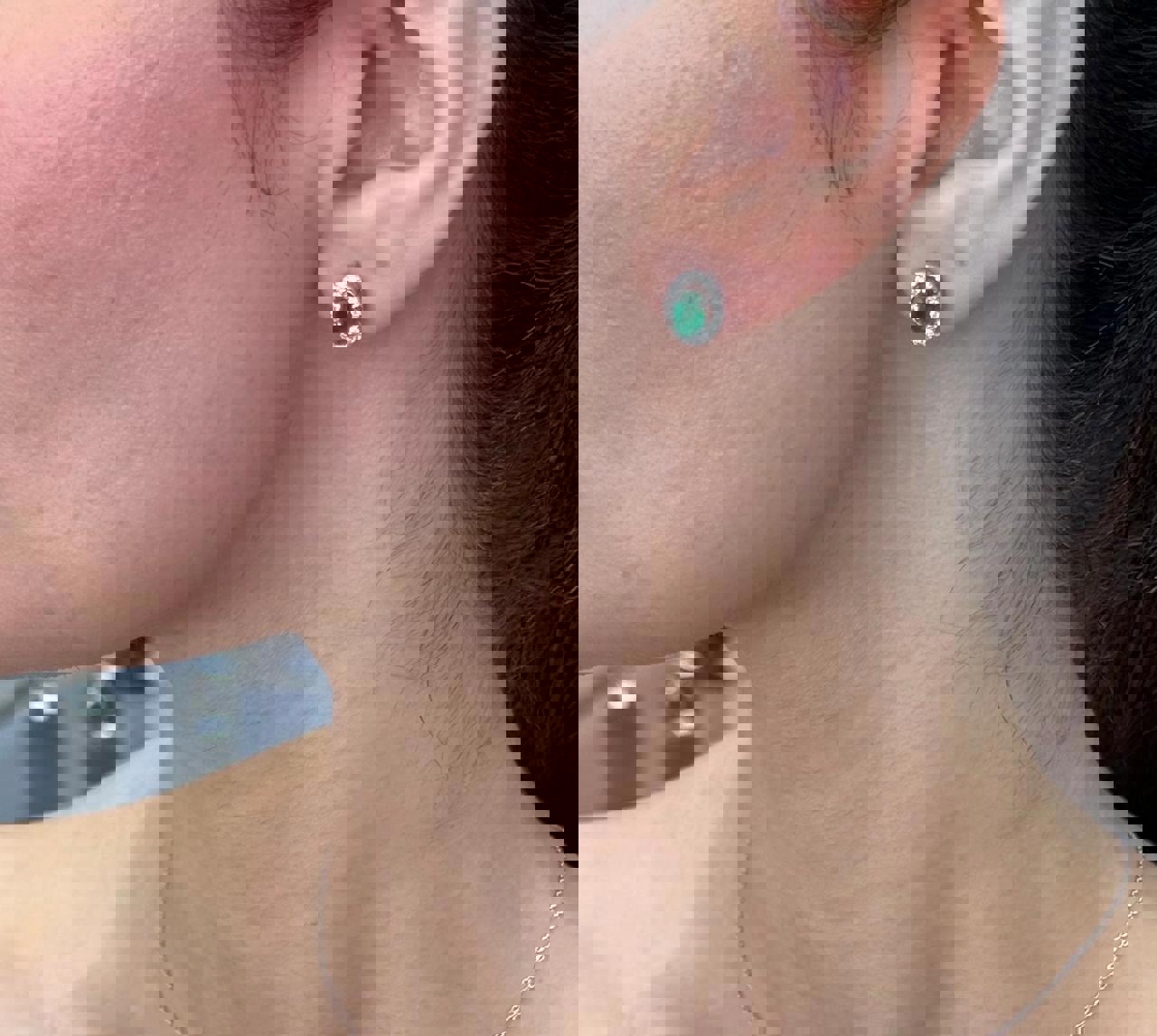 حلق اذن كلاسك